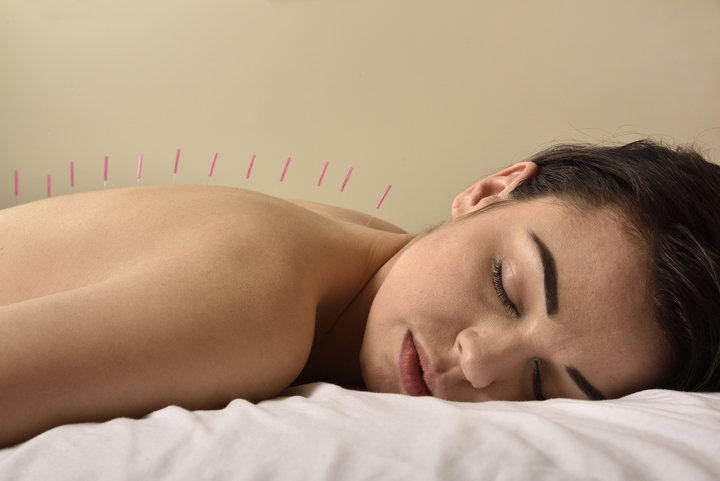 6 Benefits of Cosmetic Acupuncture Treatments